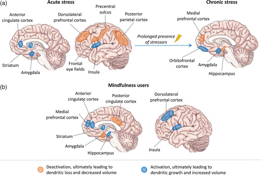 Brain-network-activity-related-to-stress-and-mindfulness-A-Brain-regions-are-activated