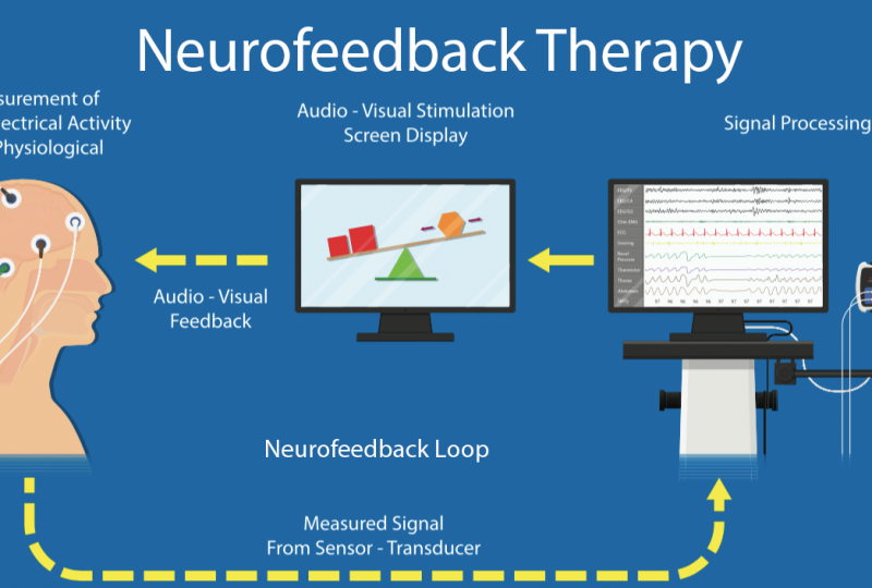 neurofeedback-upd